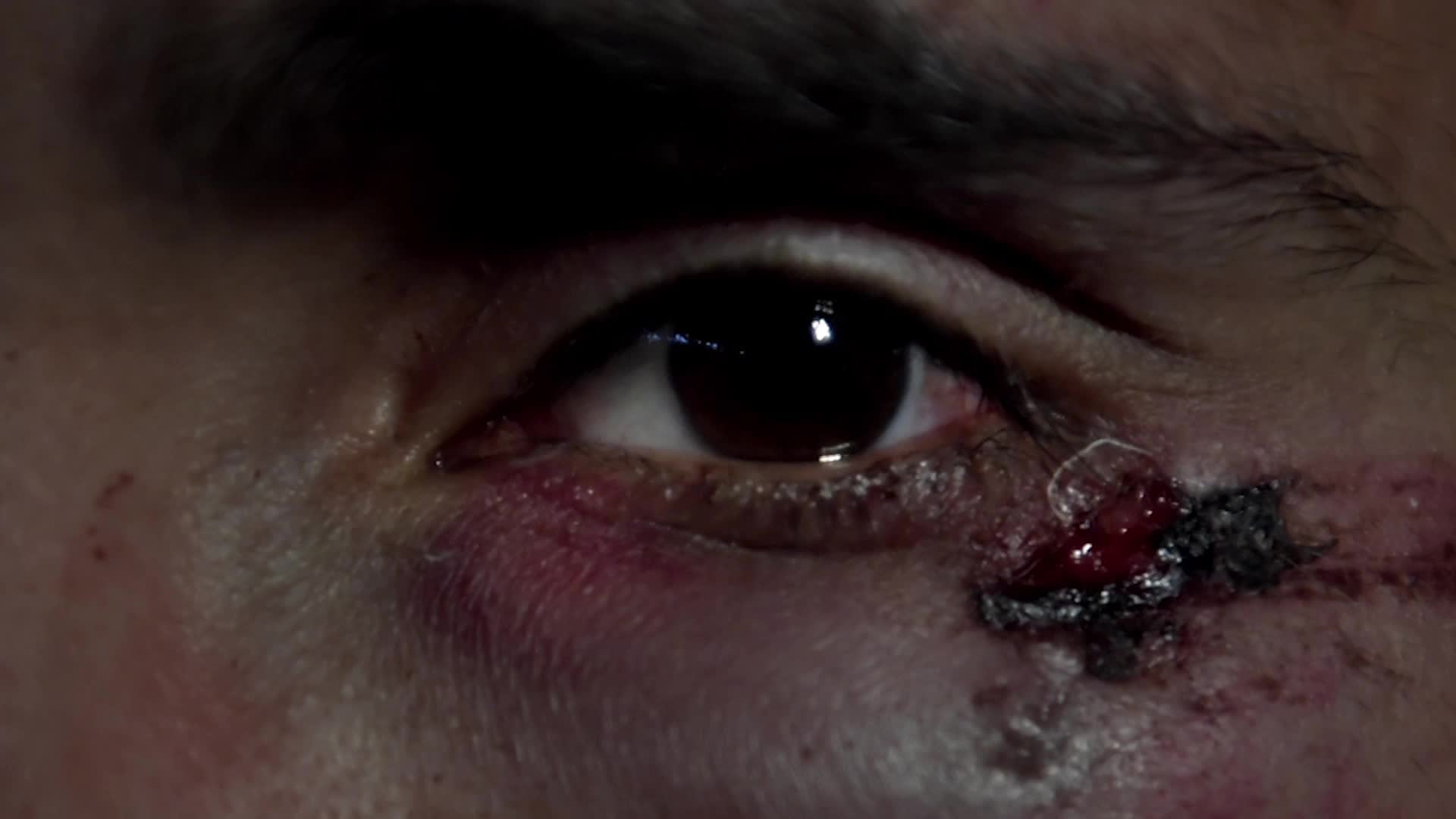 Läkare utan gränser: Det är oroande