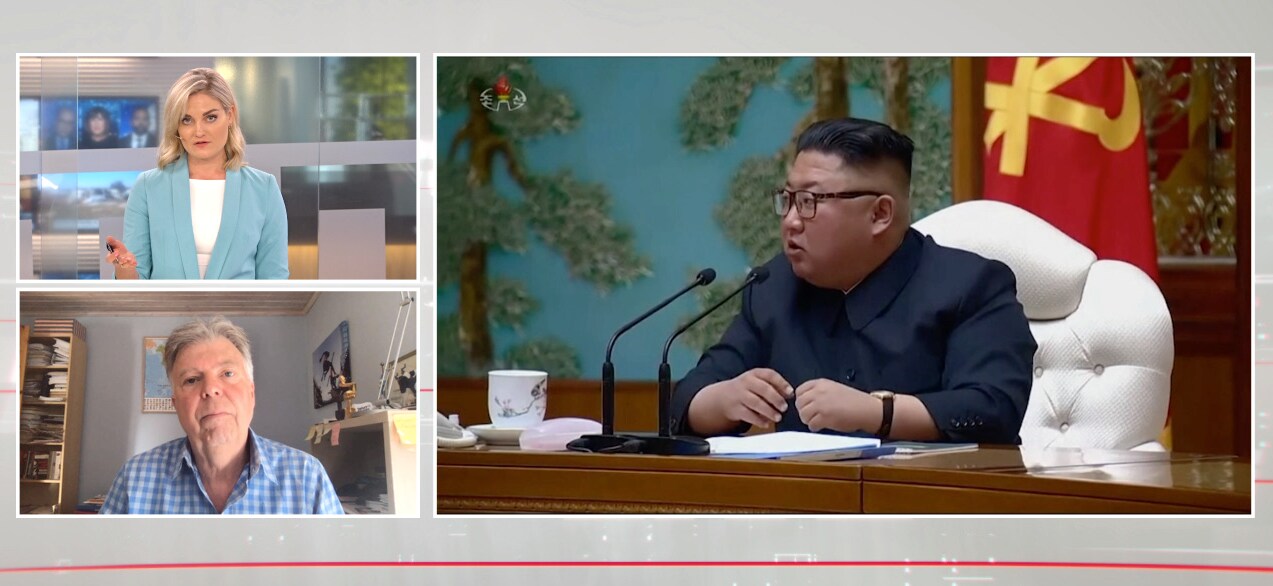KimJong-Un uppges vara allvarligt sjuk efter operation
