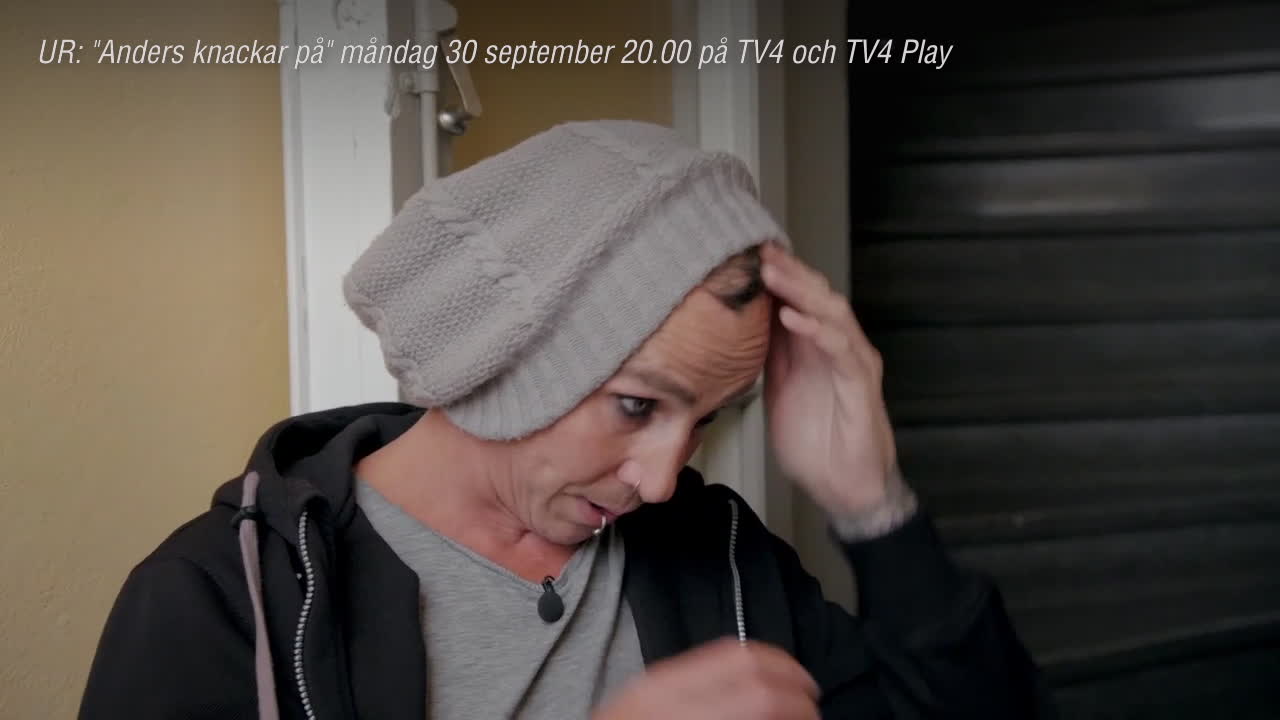 Stress fick Dregen att tappa håret