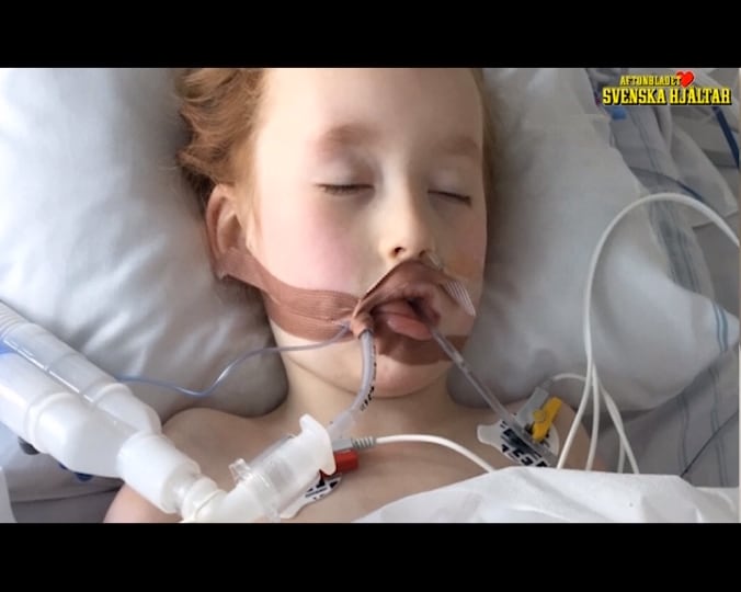 Höll på att dö av en anafylaktisk chock