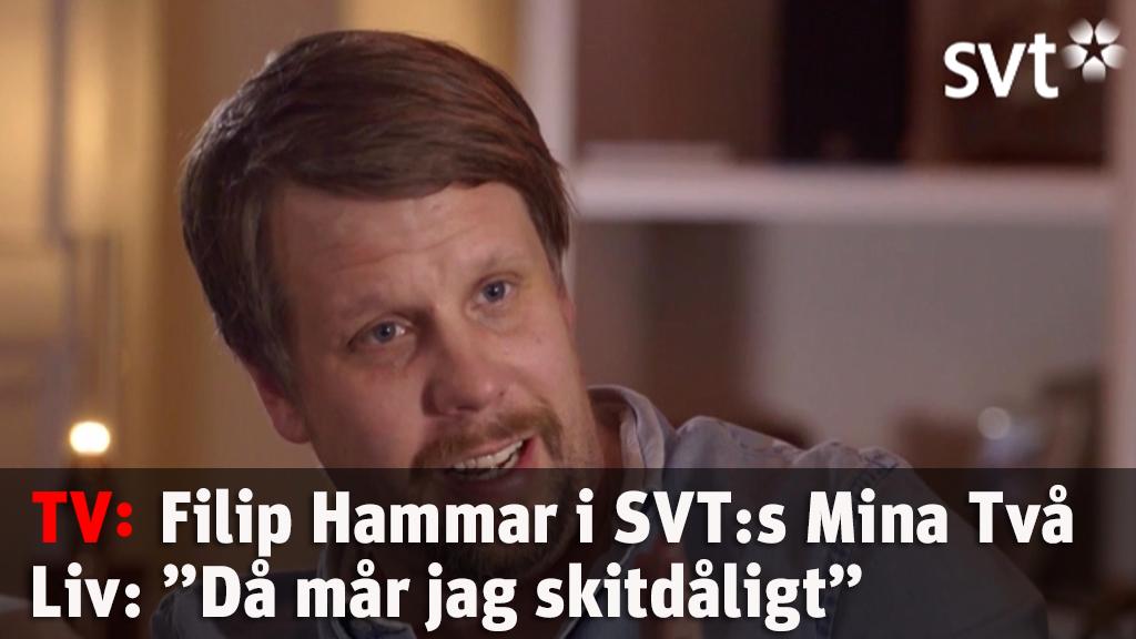 Filip Hammar om sin bipolära sjukdom: ”Då mår jag skitdåligt”