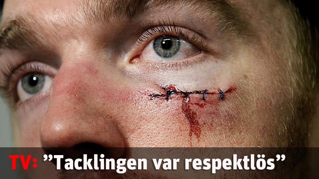 ”Jag tycker tacklingen var respektlös”