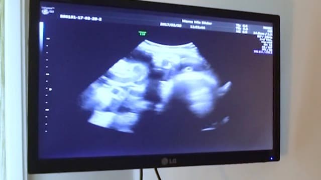 Därför gör vi ultraljud