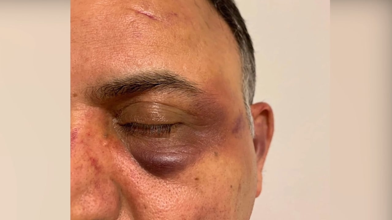 Misshandlades av väktare på akuten: "Trodde jag skulle dö"