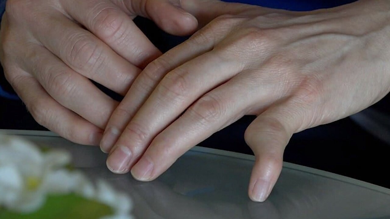 Norskans skräckskada: ”Kanske inte en helt lyckad operation”