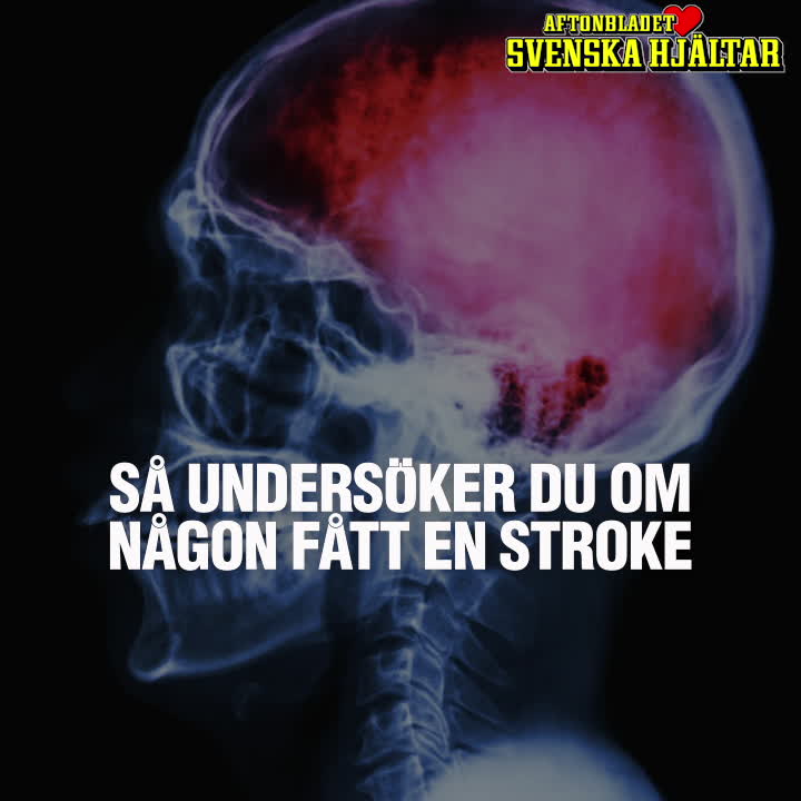 Så undersöker du om någon fått en stroke