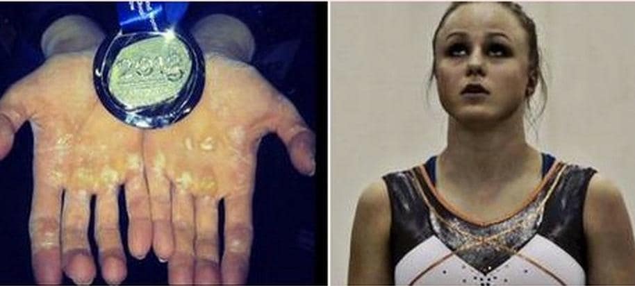 Det tuffa priset för medalj