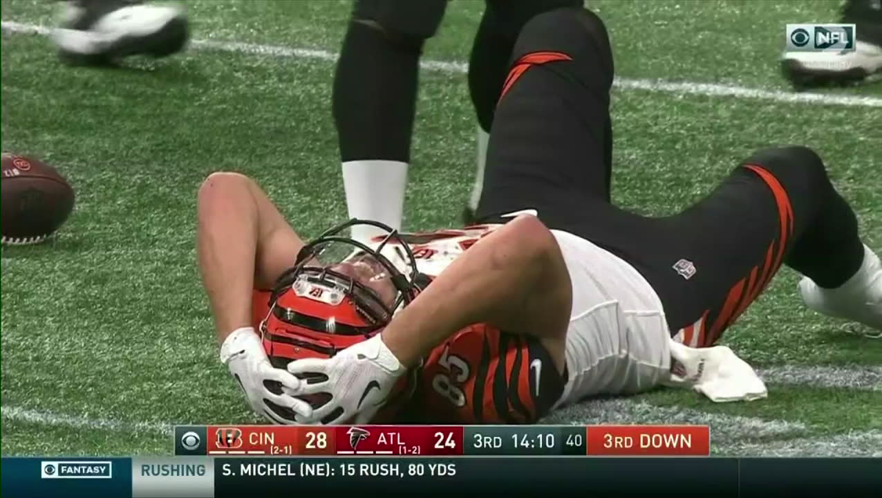 Otäcka bilder: Skräckskadan i NFL