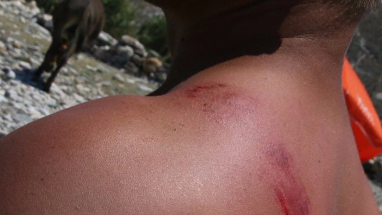 Berättar själv om åsneattacken