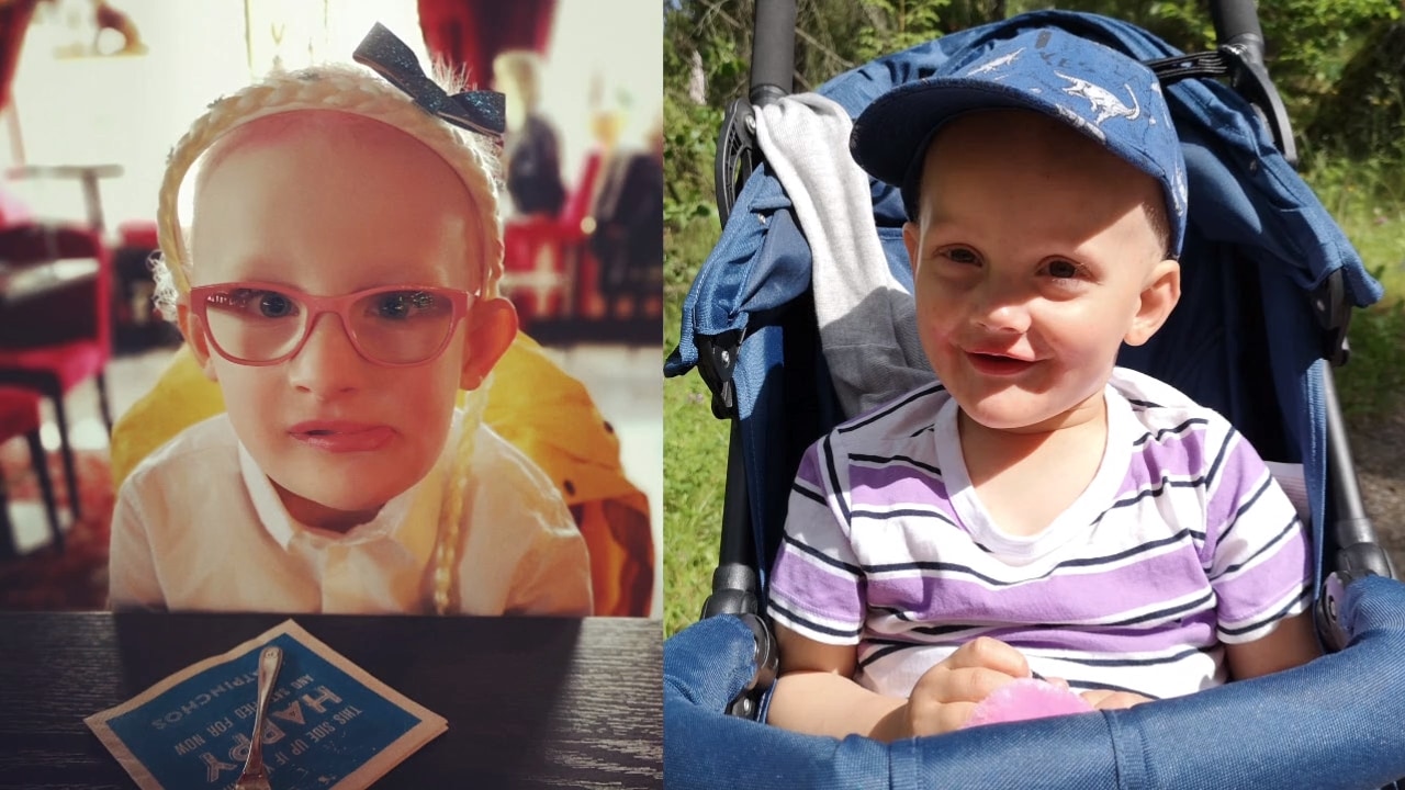 Barnen har tvingats operera ut tänderna