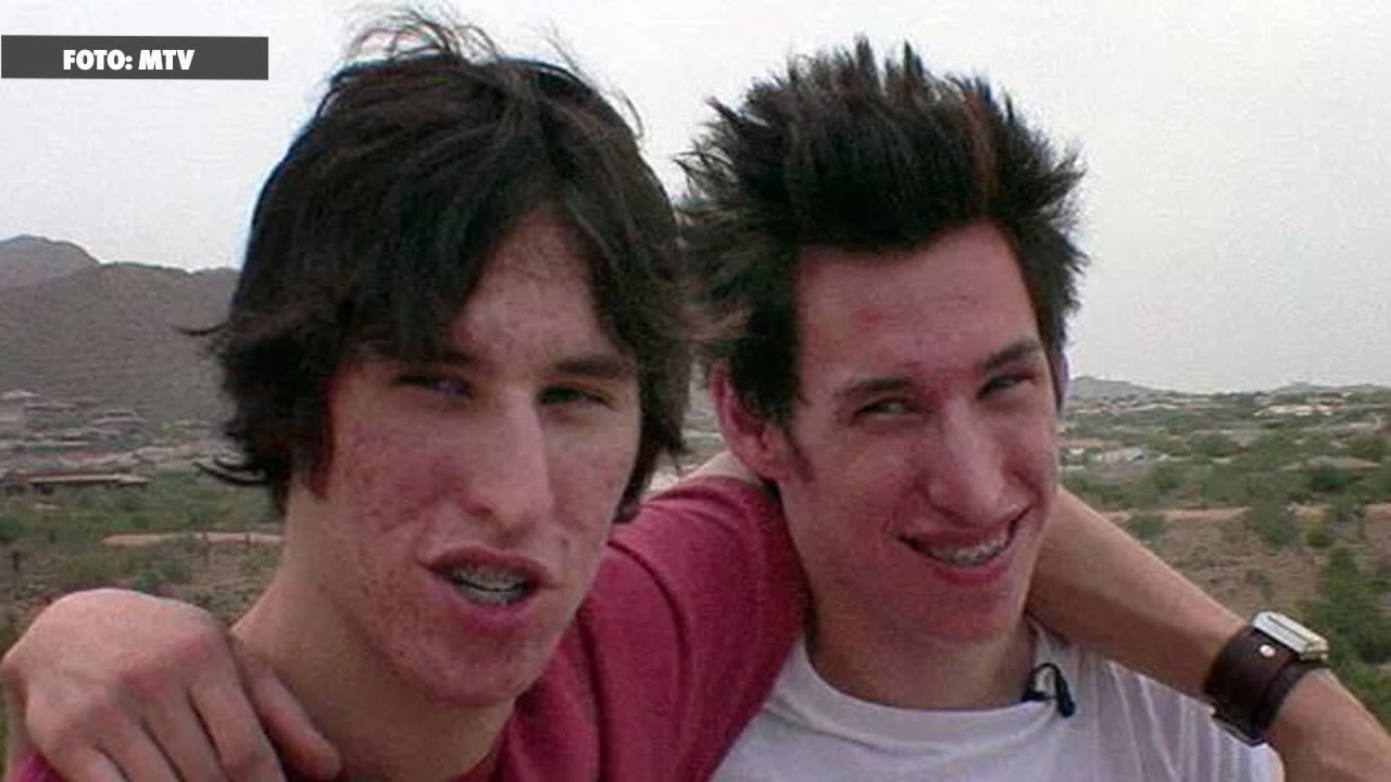 Opererar sig - för att se ut som Brad Pitt