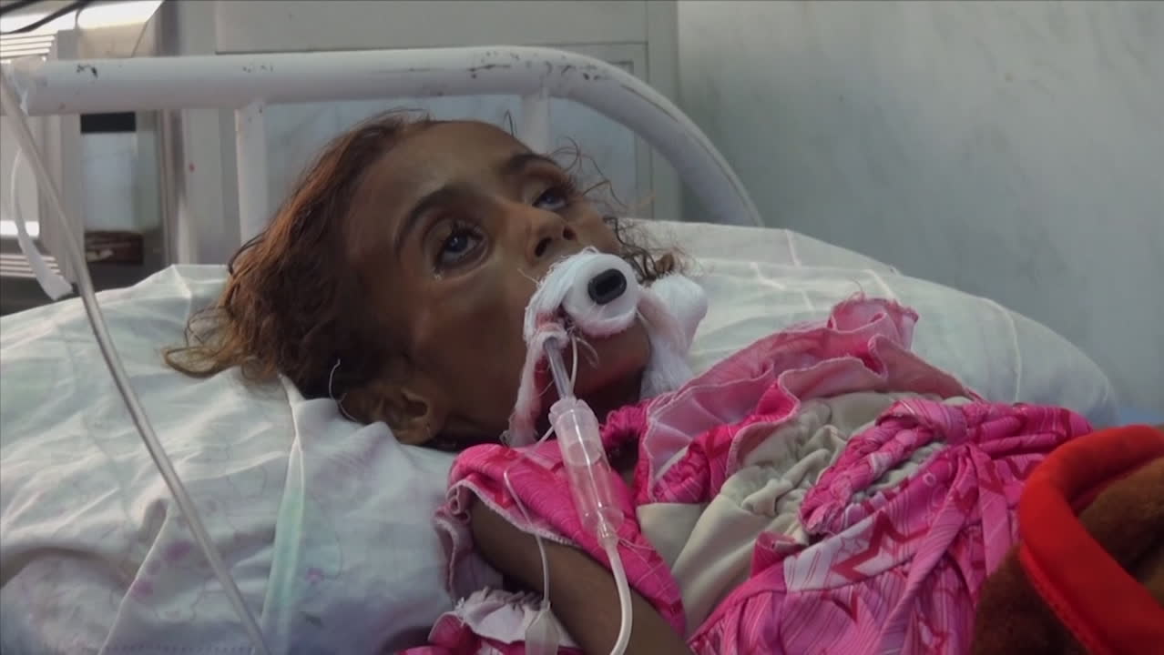 Jamila, 7, dör av hungersnöd