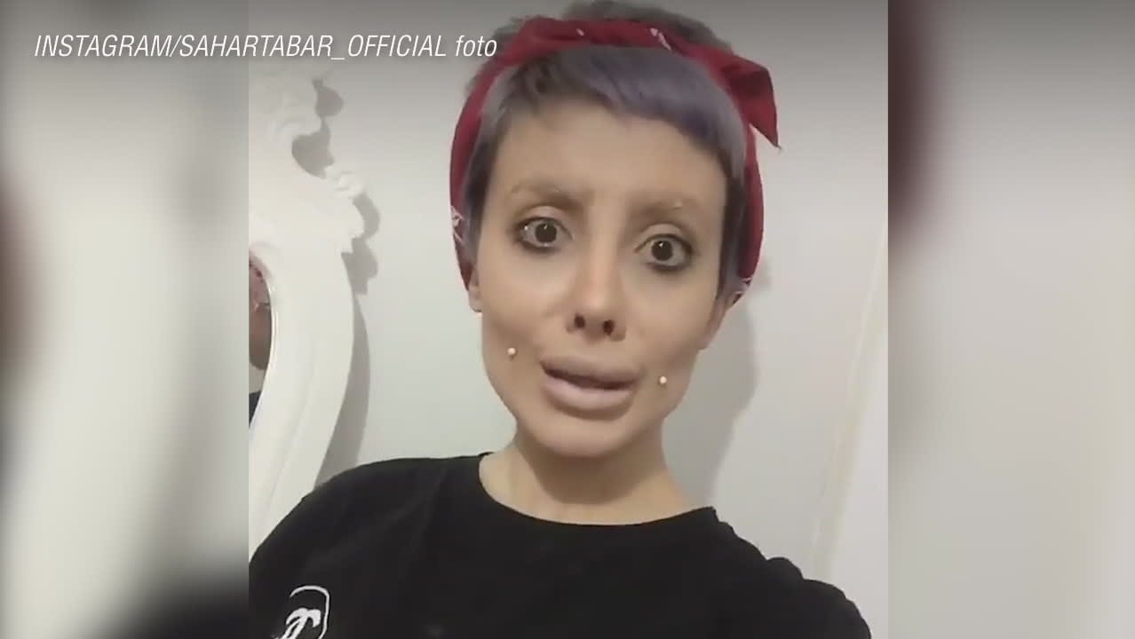 19-åringen vill se ut som Angelina Jolie – ”opererat sig 50 gånger”