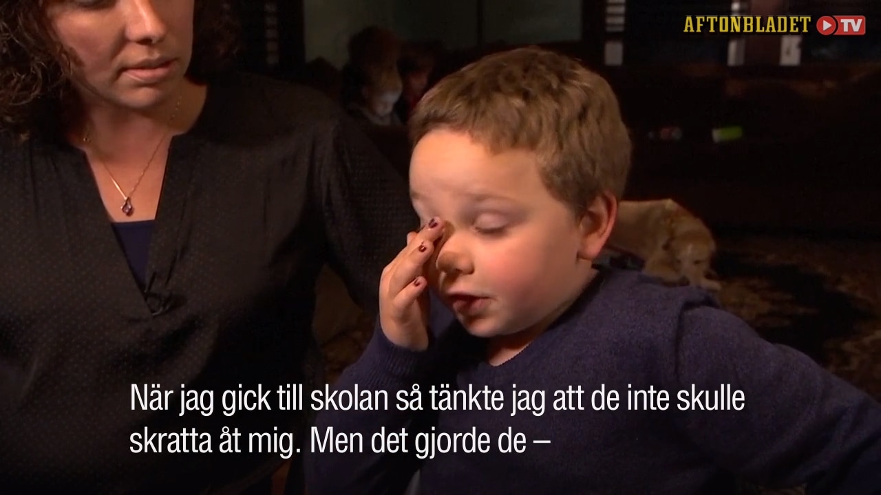 Sam, 5, målade naglarna – blev utskrattad på förskolan
