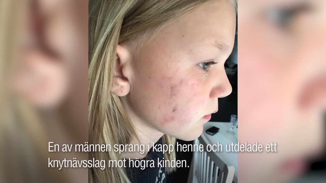 Hanna, 11, attackerades av okänd man – blev slagen i ansiktet