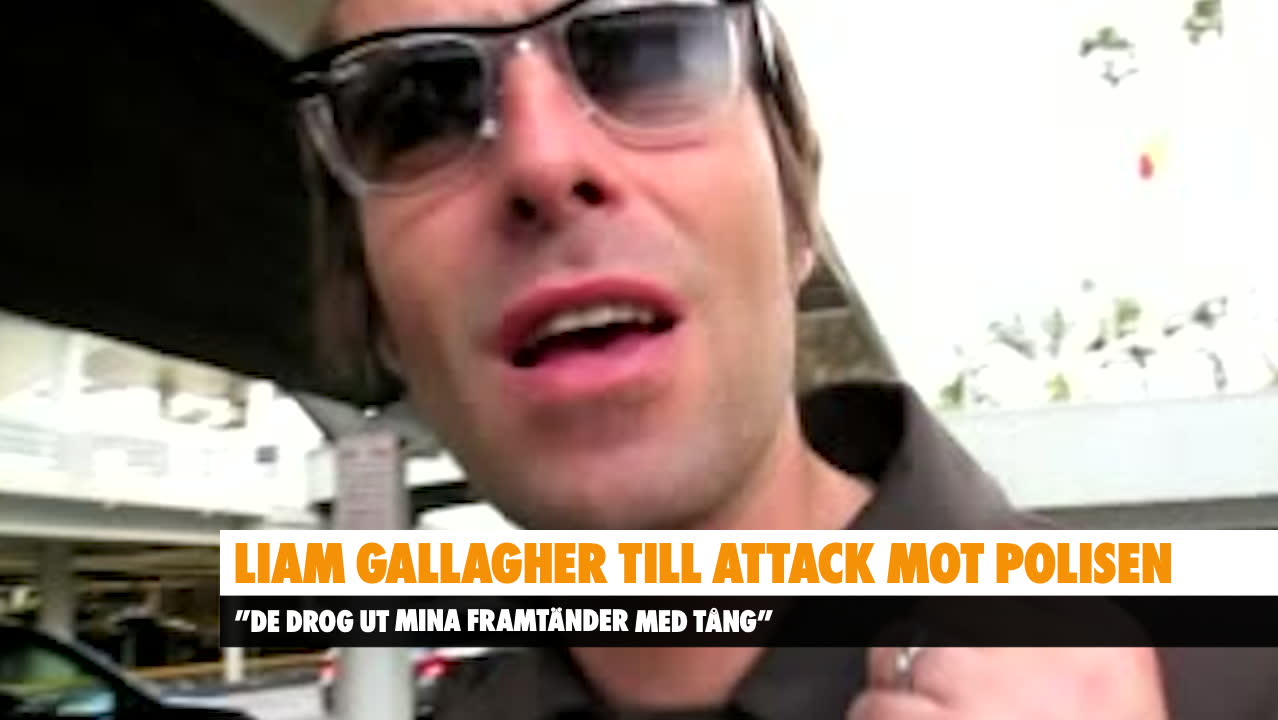 Liam Gallagher: Tyska polisen drog ut mina tänder med tång
