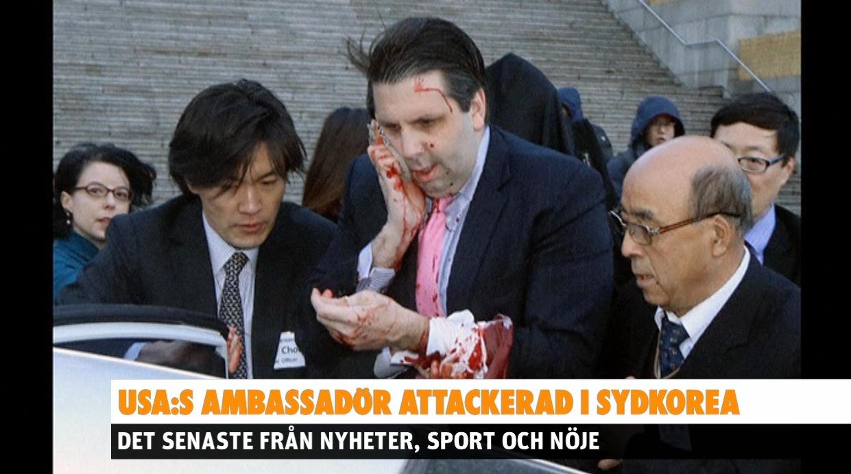 USA-ambassadör attackerad med rakblad