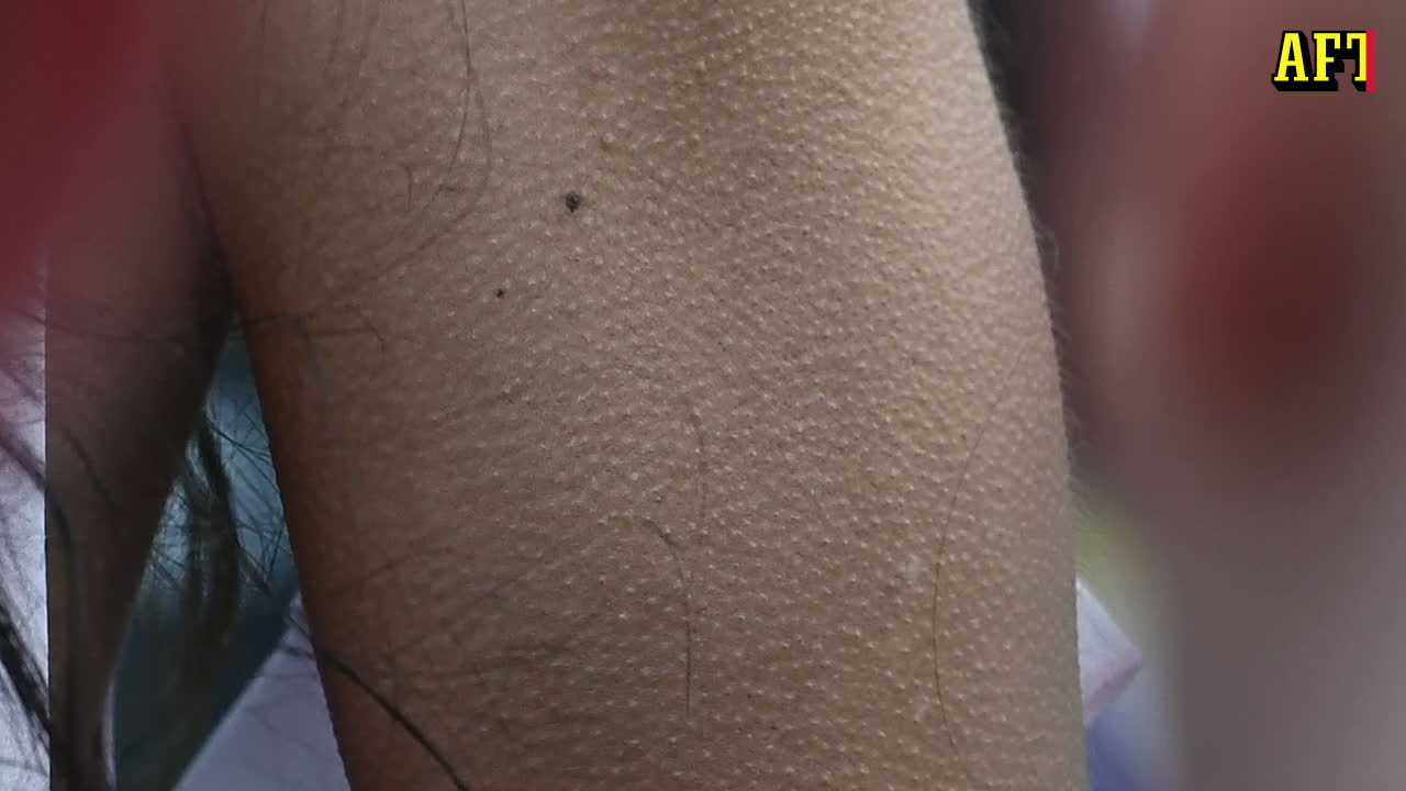 Loreens iskalla start på Eurovision: "Jag snor lite värme från alla"