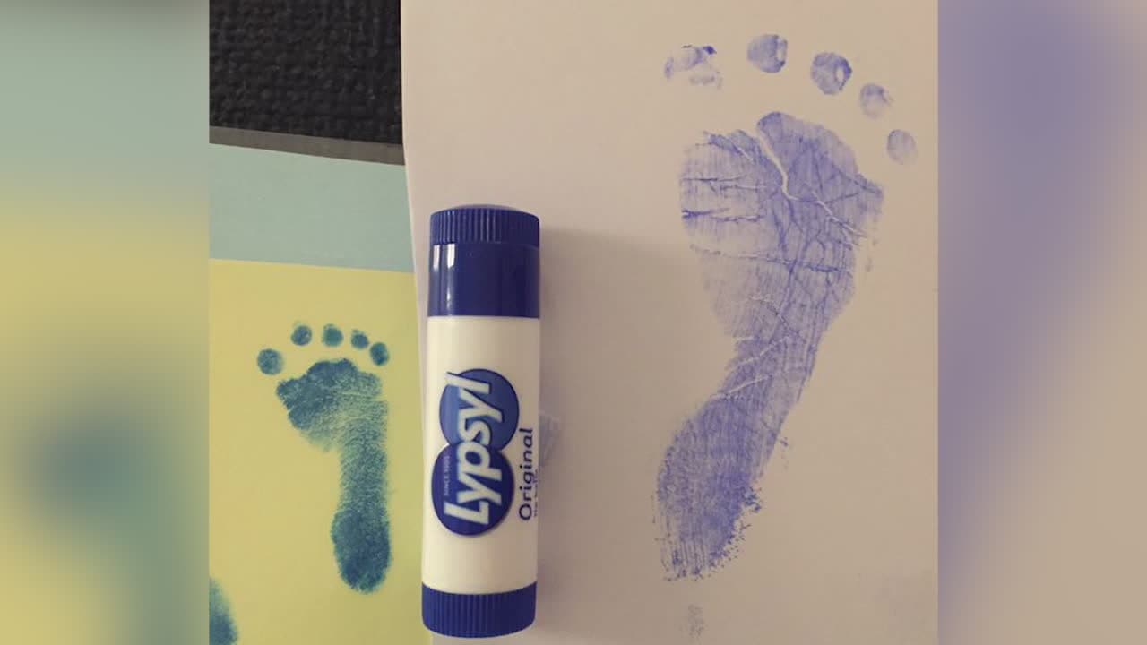 Hon födde sin son i vecka 24