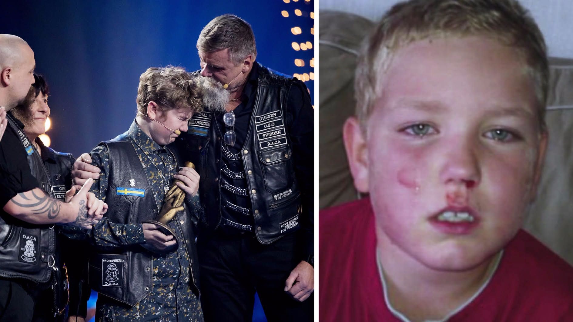 Benjamin blev slagen i skolan – mobbades i flera år