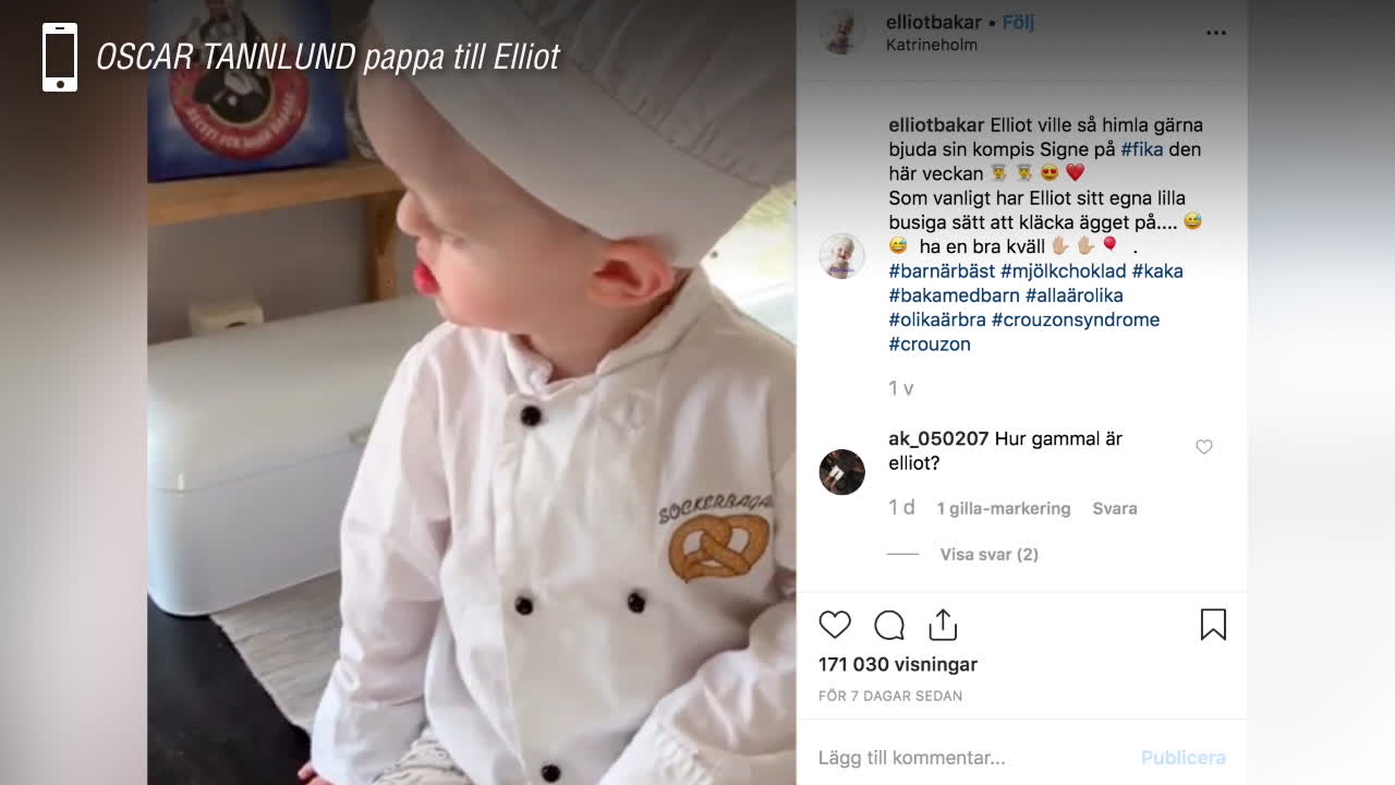 Elliot, 3, har sällsynt syndrom – blev kändisbagare på Instagram