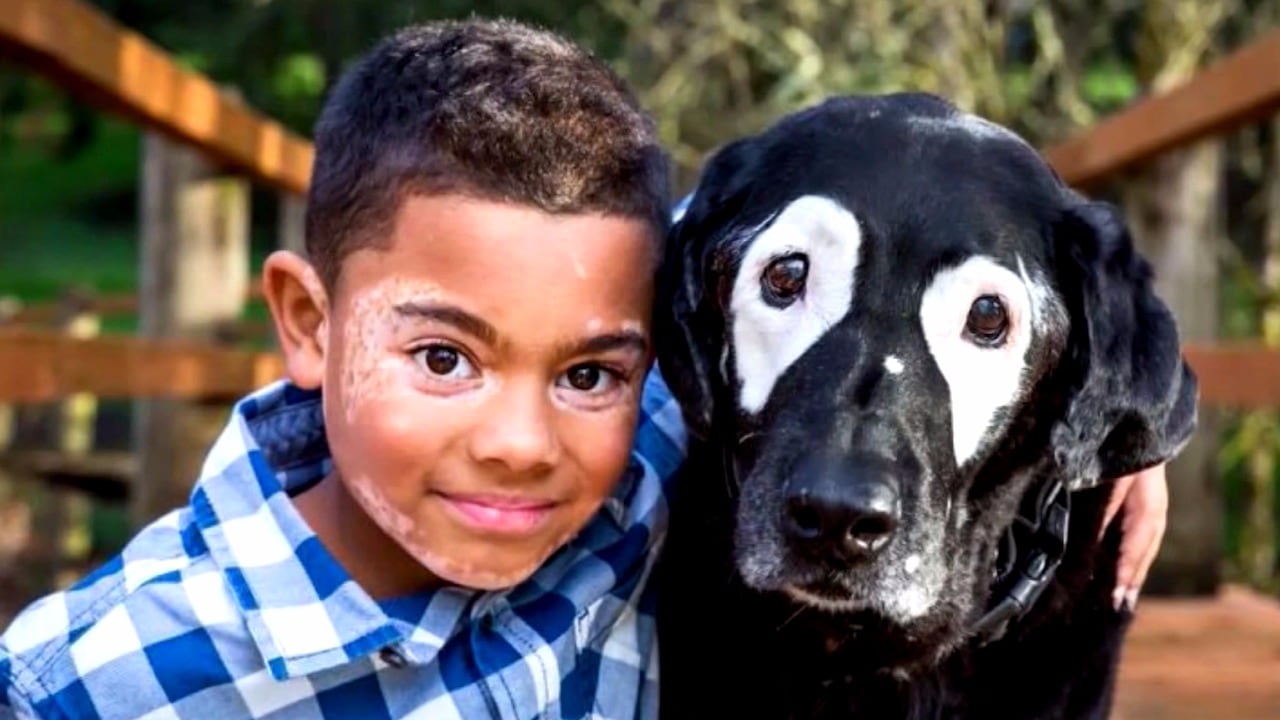 Hunden och pojken är bästa vänner - har samma sjukdom