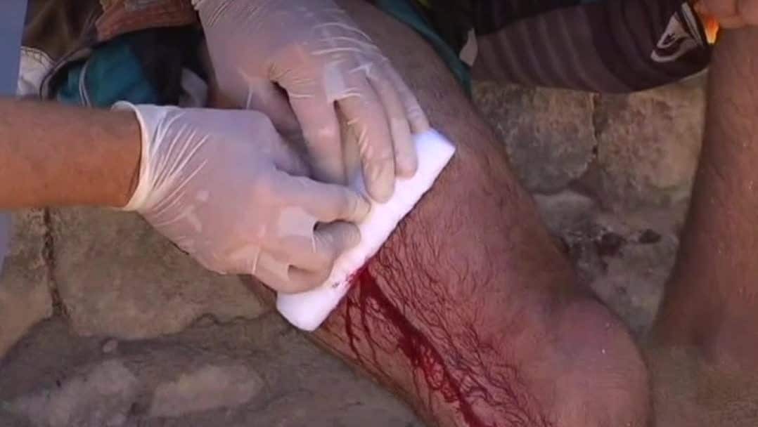 Efter hajattacken: "Den kom rakt mot mig"