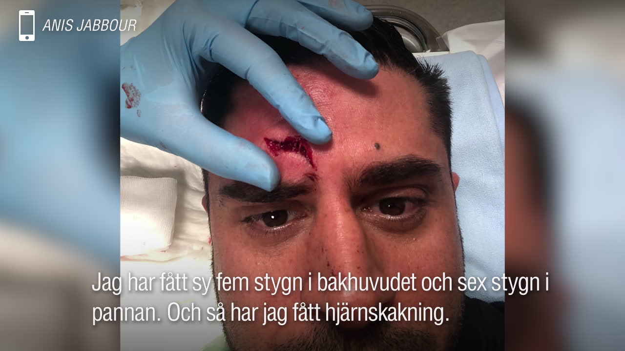 Här är Anis hårda kritik mot gymmet – efter olyckan