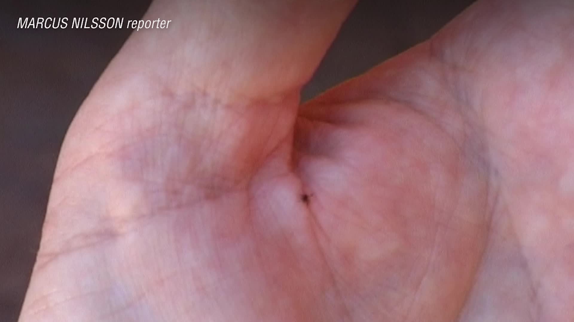 Fästingar med blödarfebervirus funna i Europa