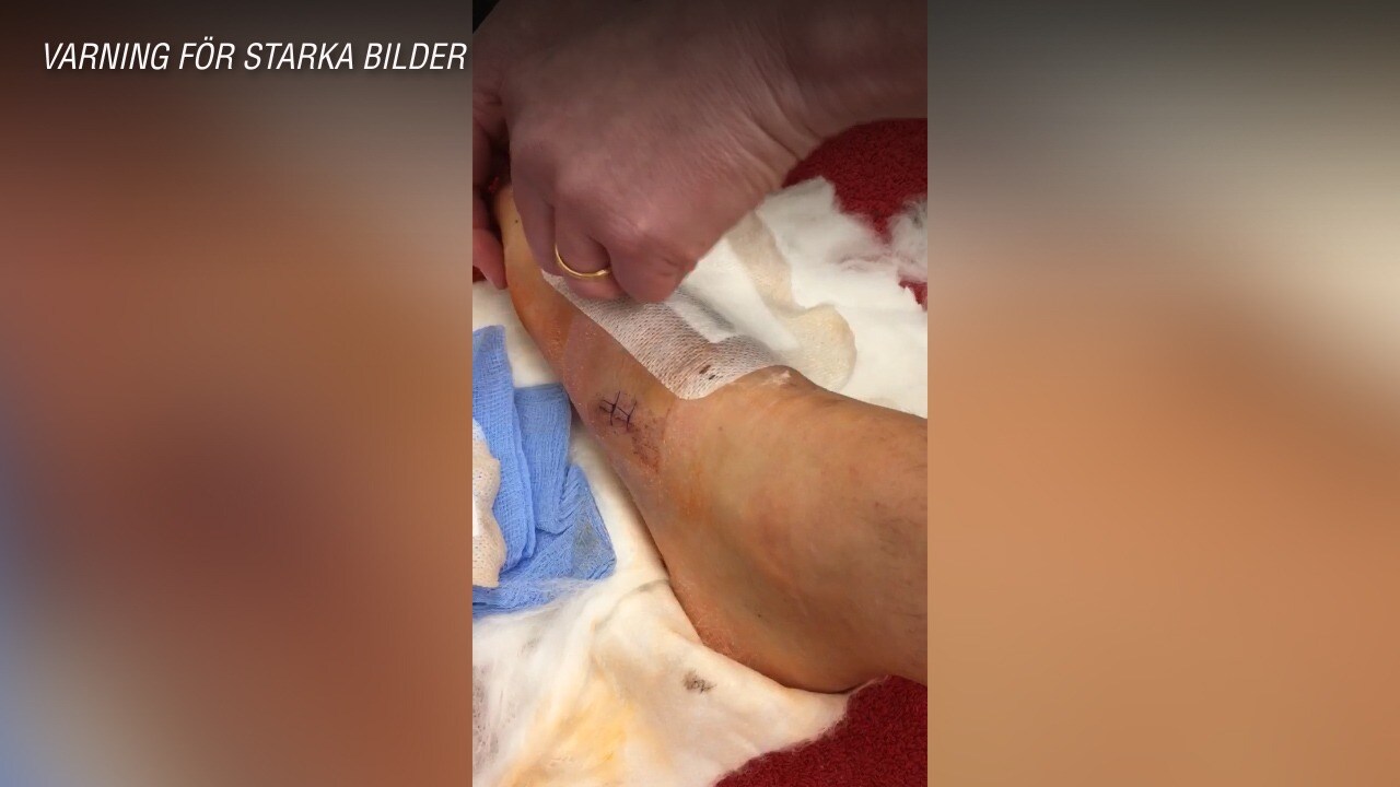 Här visar Samuelsson upp skräckskadan