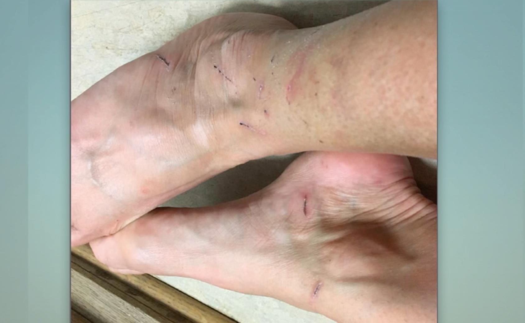 Lotta dokumenterade själv sitt helvete