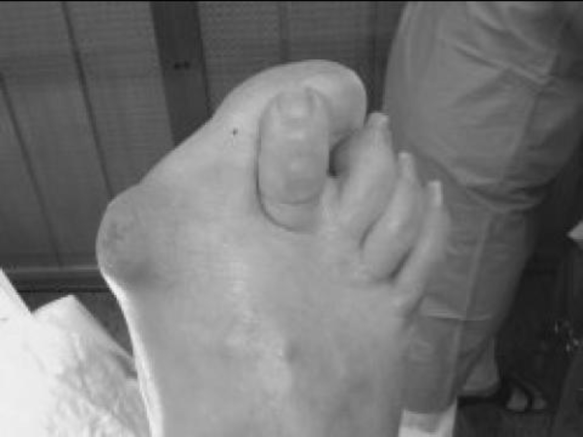 Damesko gir problemer