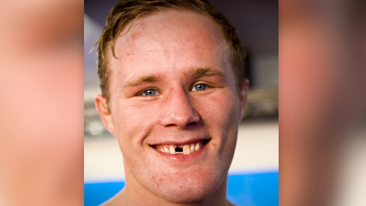 EMgull til «tannløse» Morten Thoresen Jeg burde få meg gulltann nå